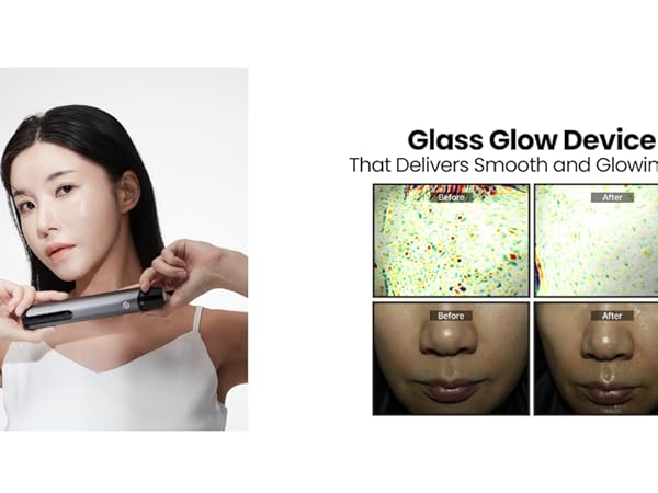 ホンボディ ニードルポテンショット 美顔器 HONBODY Amazon.com: Honbody Reedle Fotenshot Glass Glow Skin Device