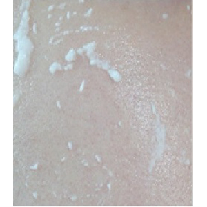 Peeling Gel
