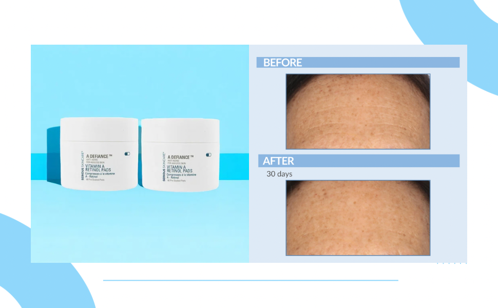 Image of A Pads and woman's forehead with visibly fewer lines after 30 days of use.