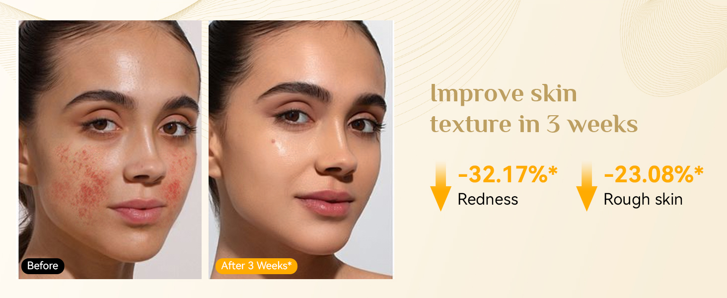 Before and after facial skin comparison showing improvements in redness (-32.17%) and rough skin (-23.08%) over 3 weeks, demonstrating effectiveness of a skin care product.