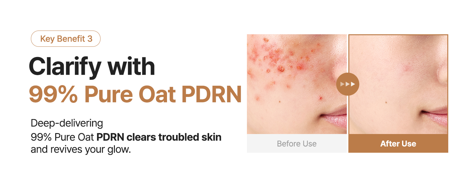 korean skin care toner, hydrating oat toner, pdrn toner, k beauty toner, soothing oat toner