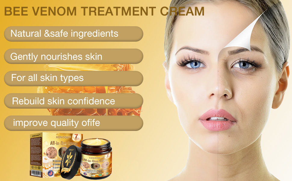 Amazon.com: ADNOON Bee Venom Al-in-One Cream, 2025 New Professional Bee - Does Bee Venom Work To Remove Skin Tags