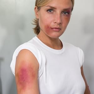 bruise wheel in use, bruise makeup on woman's arm, cheek, and eye areas
