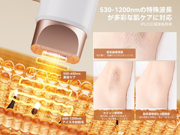 Amazon | YUNDOO脱毛器 【自宅でｻﾛﾝ級脱毛体験ﾃﾞｷ|IPL光脱毛器