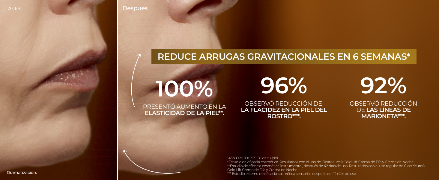 Cicatricure Gold Lift Crema día FPS 30 Reduce arrugas gravitacionales marionetas piel sana