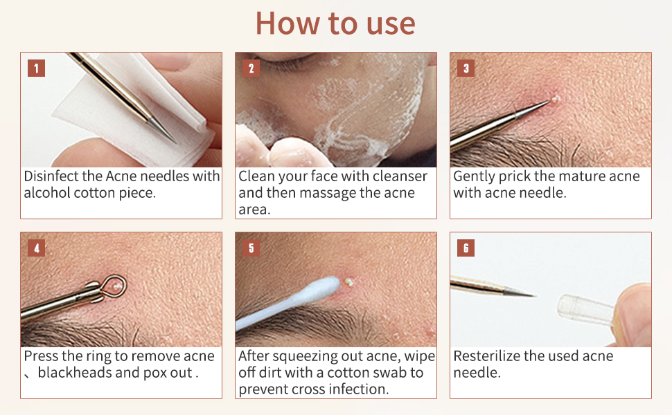 GERY blackhead removal tools