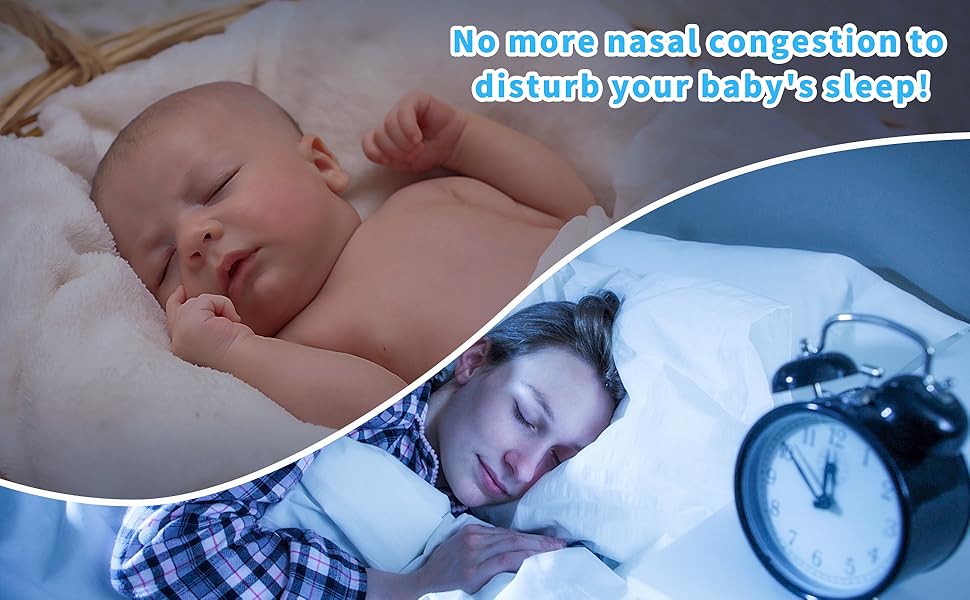 Aufisi Nasal Irrigator for Baby 10ml Professional Baby Nasal Aspirator