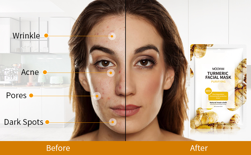 Sheet Masks Turmeric Face Sheet Mask for Acne, Anti Acne