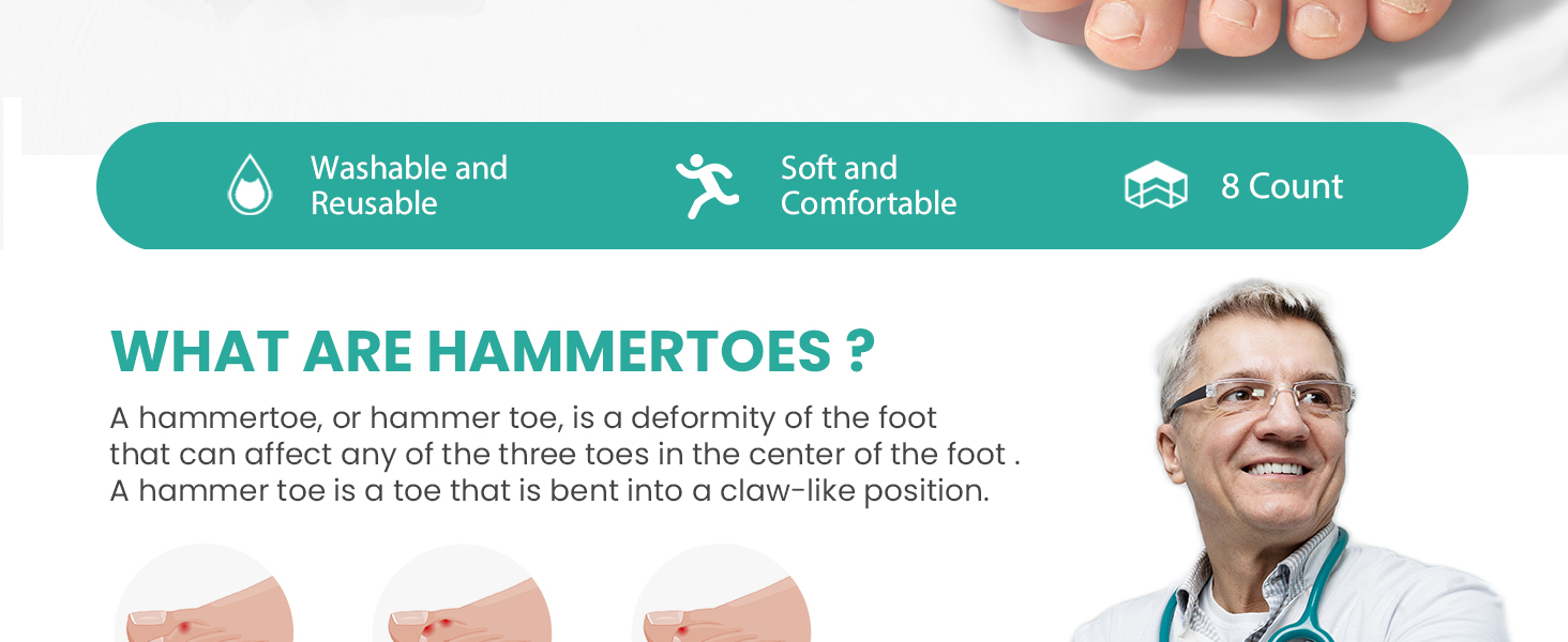 toe straighteners for curled toes