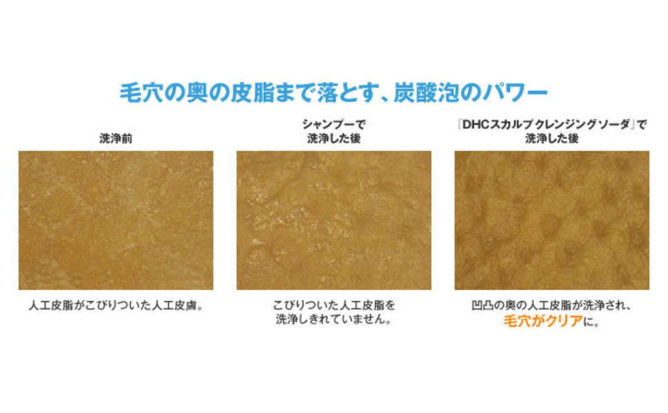 Amazon Dhcスカルプ クレンジング ソーダ Dhc ディー エイチ シー ヘアケア 通販