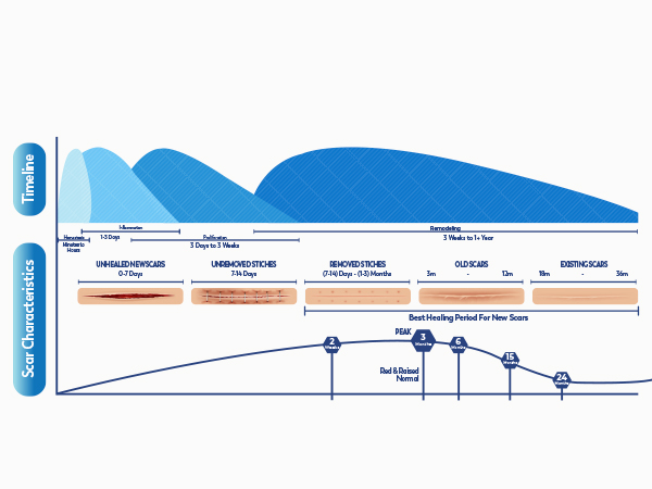 100% Silicone Scar Gel Scar Cream M7-3