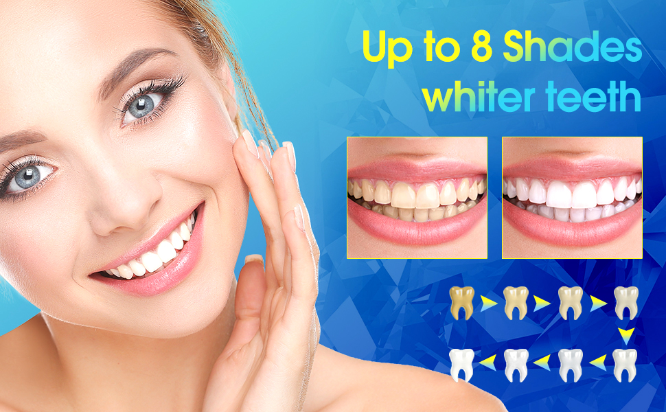 Teeth Whitening Kit, Teeth Whitening Kit with LED Light Teeth