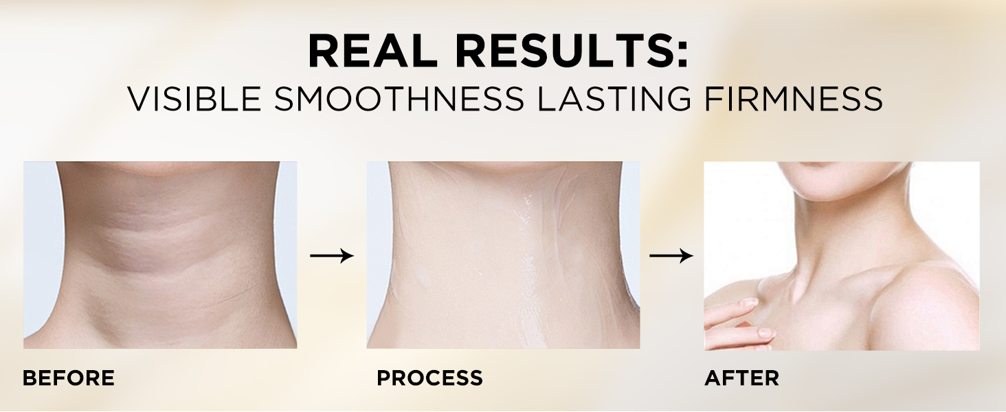 ASAMO MOISTURIZER FOR NECK