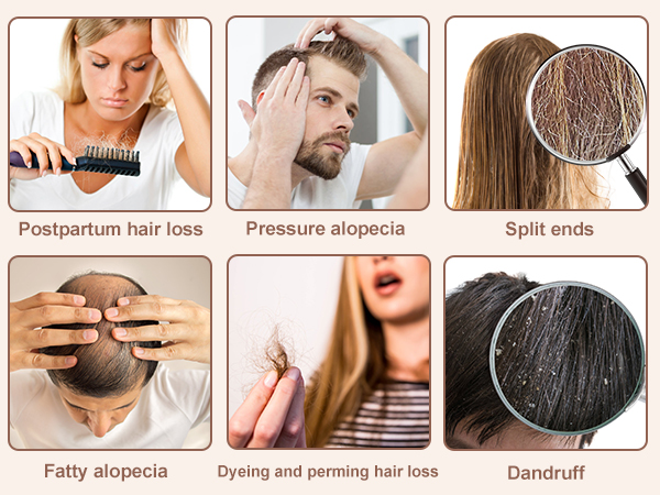 Infographic showing six types of hair issues: postpartum hair loss, pressure alopecia, split ends, fatty alopecia, dyeing and perming hair loss, and dandruff. Each with an illustrative image.