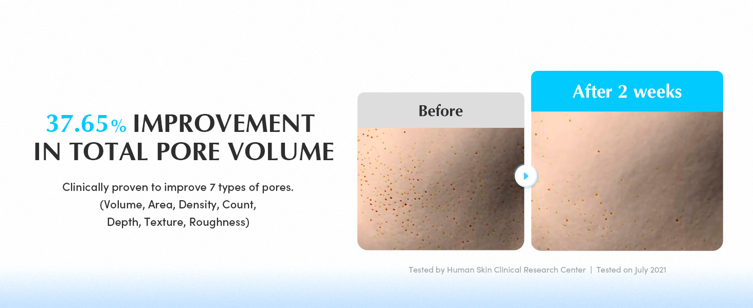 c1a5c884-1b19-4db9-95f8-4d26814b04e2.__CR0,0,1464,600_PT0_SX1464_V1___.jpg (1464×600)