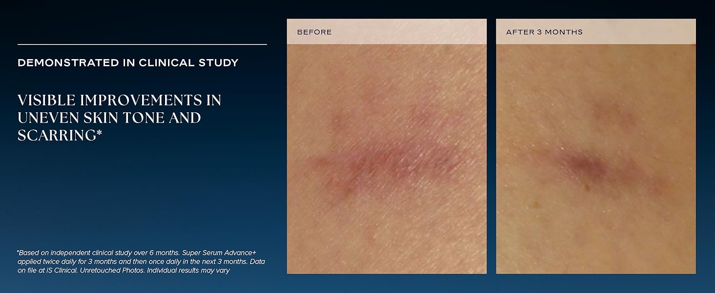 visible improvements in uneven skin tone and scarring clinical study