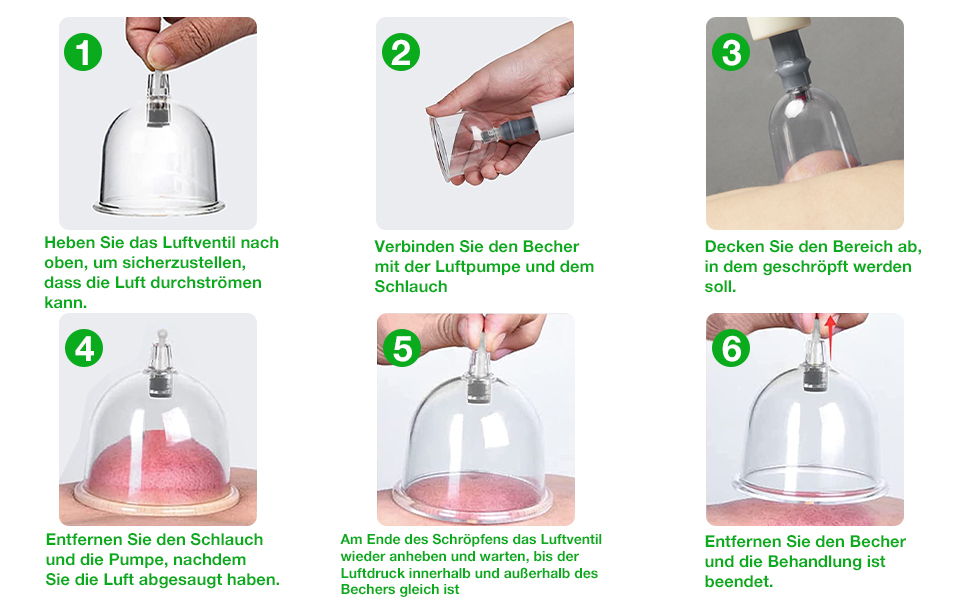 Schröpfgläser mit Vakuumpumpe, Cupping Set,18 Stück Schröpfsets für ...