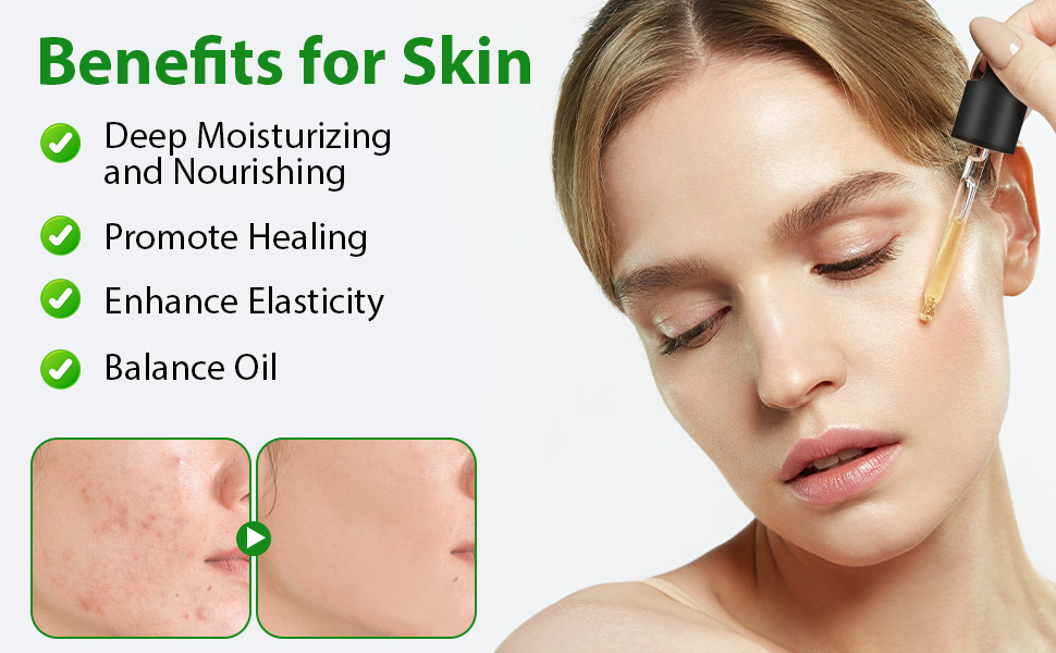 Jamaican Black Castor Oil for Skin Care
