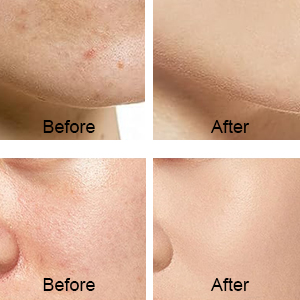 Skin Care Gifts for Women