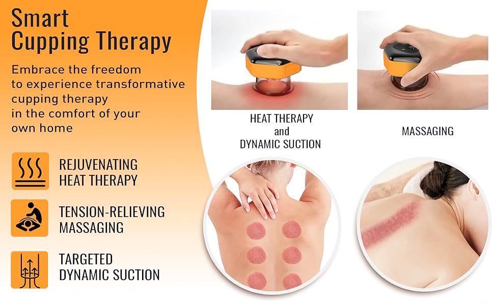cupping therapy set
