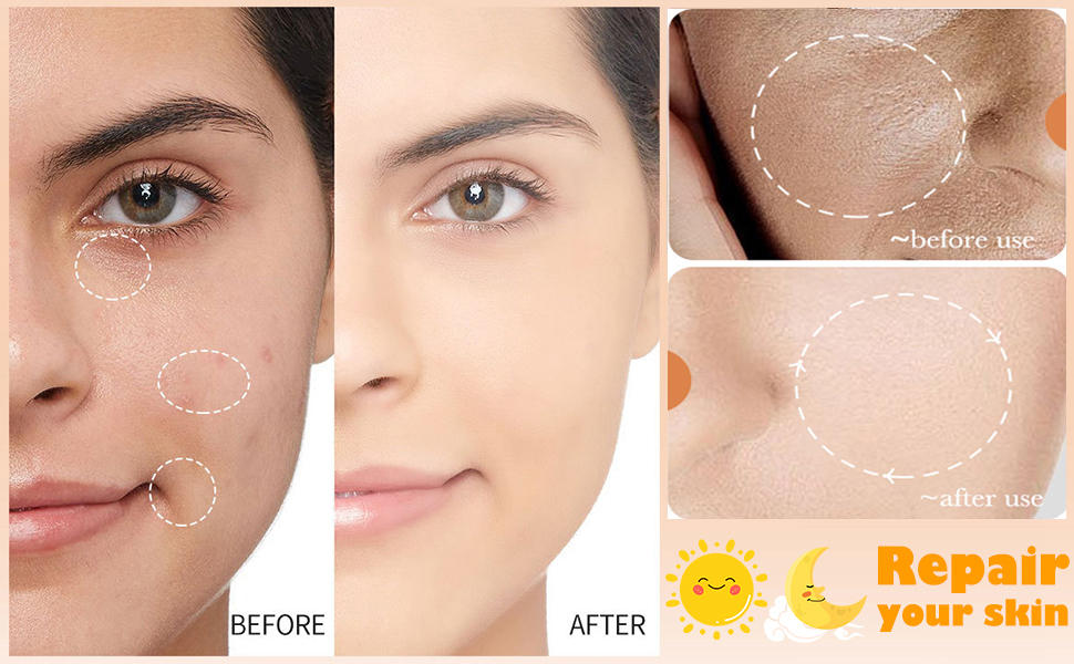 this skincare set has Nicotinamide, which is an all-round skin care ingredient known