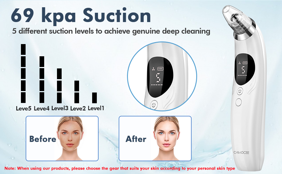 Blackhead Remover