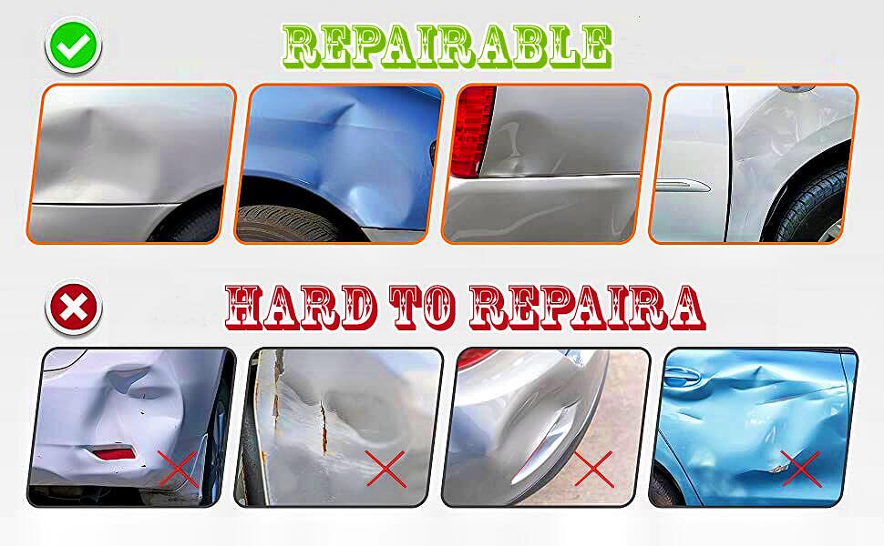 dent removal kit