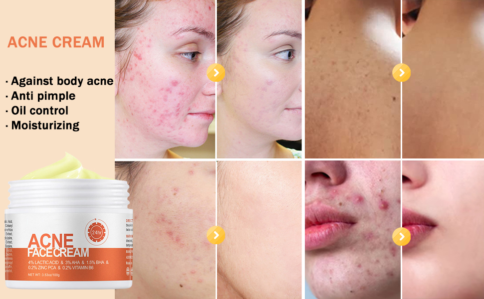 face cream