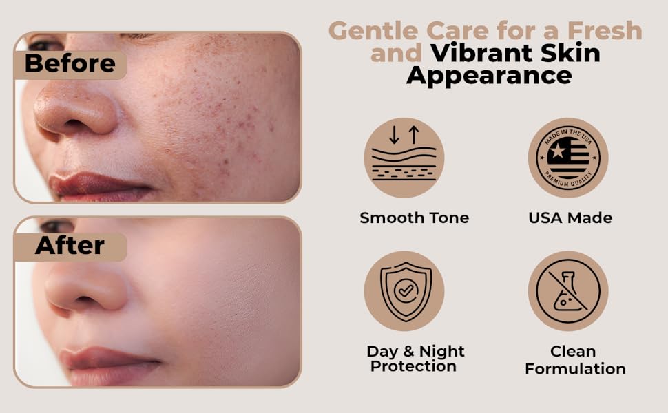 crema para melasma en la cara