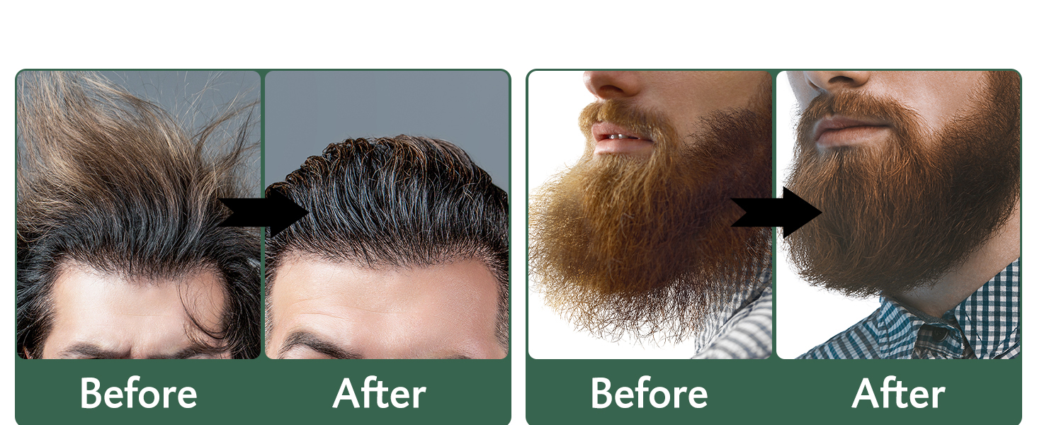 مكواة فرد اللحية للرجال