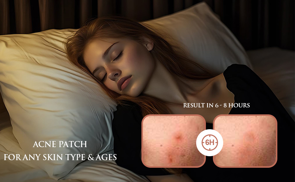 pimple patches with salicylic acid