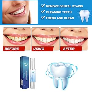 Herbaluxy Teeth Whitening