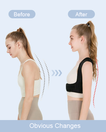 back brace for women