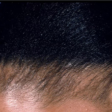 rosemary and biotin pre-wash scalp and hair treatment oil for hair growth stimulation 