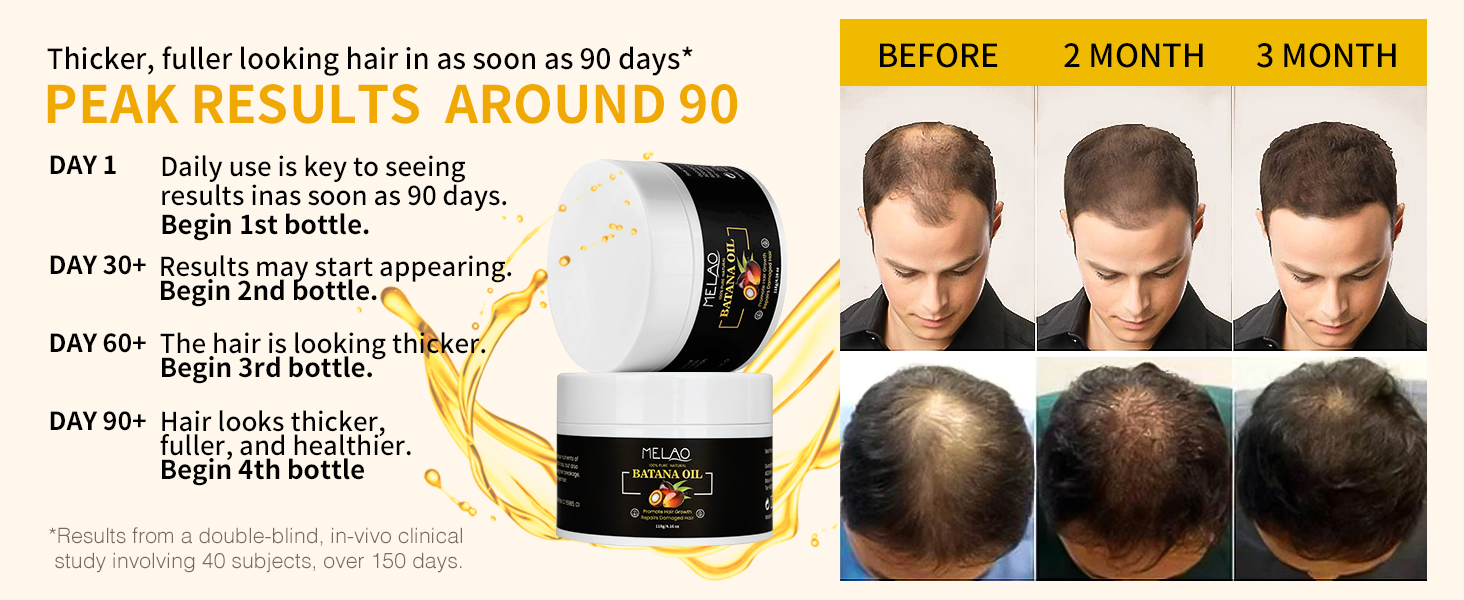 bantan oil for hair growth