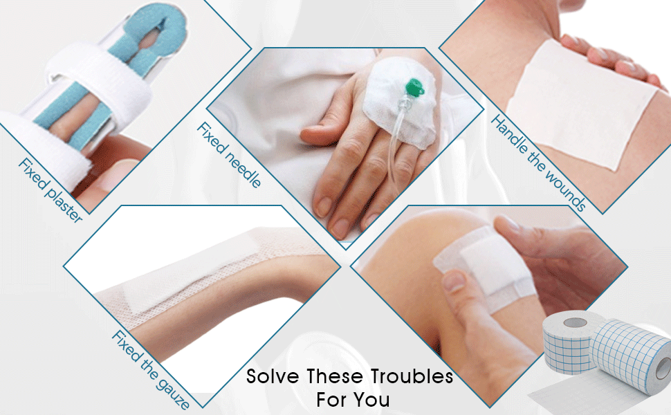 COMOmed NonWoven Cover Roll Stretch Tape 2"x10.94Yd