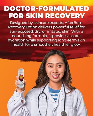 AfterBurn Recovery Lotion