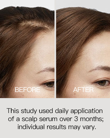 Rosemary Hair Thickening Serum with Biotin, Caffeine for Hair Thinning & Shedding