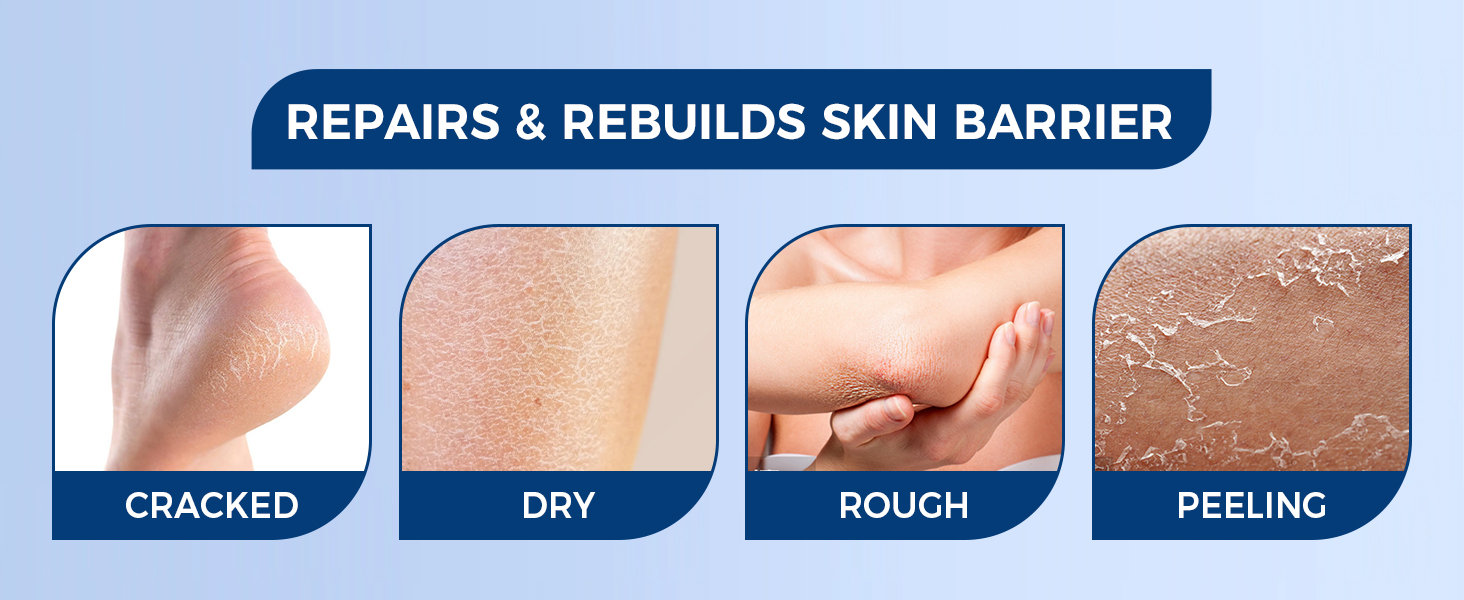 foot cream;urea cream 40 percent for feet;urea cream;foot cream for dry cracked feet;urea 40