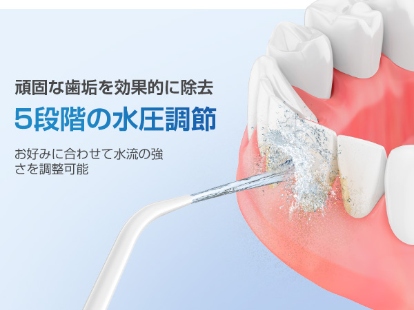 Amazon.co.jp: 口腔洗浄器 ジェットウォッシャー【歯垢除去率