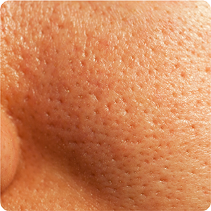 Serum Redutor De Poros