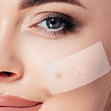 blemish spot treatment