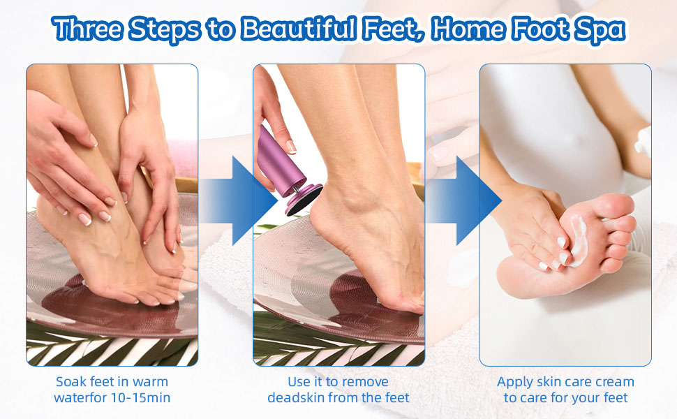 HOVGN electric foot file electric foot callus remover