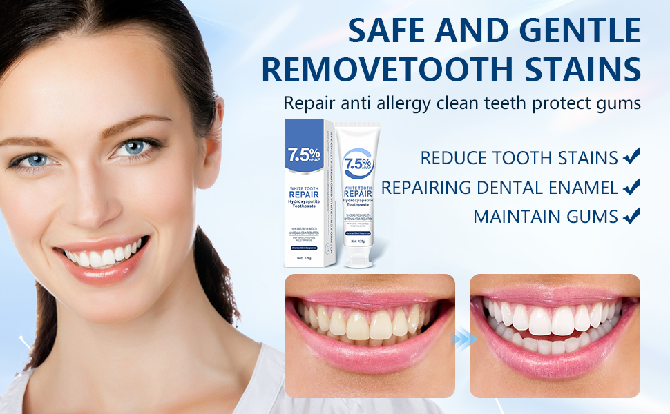 Hydroxyapatite Toothpastes for Enamel Protection and Tooth Strengthening