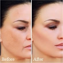 facial skin care products