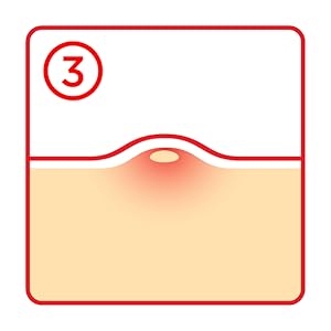 Tea Tree Clear – Dot Patch