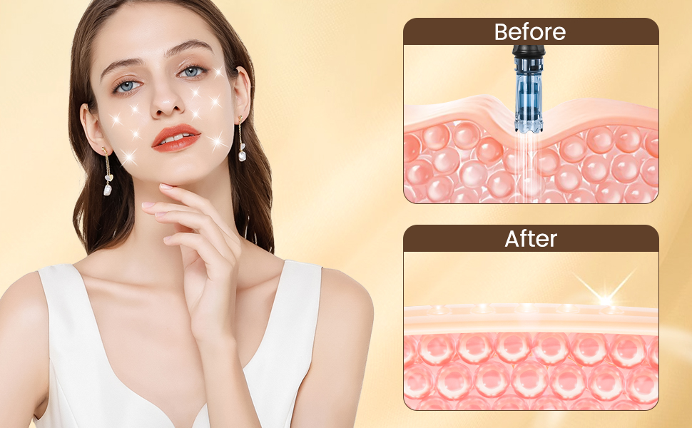 Dr.Pen A8S professional Micro Needling Pen with 8 Pcs 12Pin 36 Pin