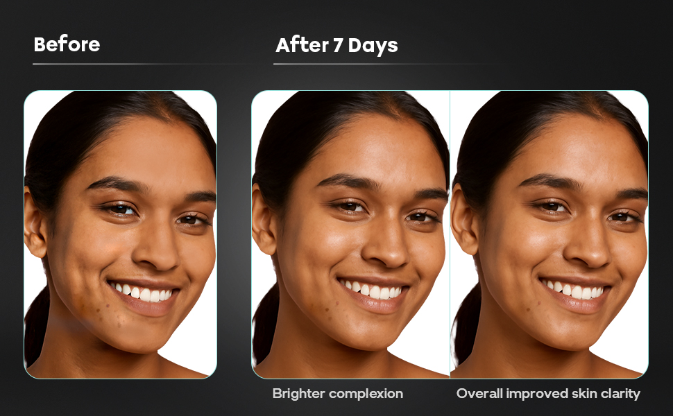 All skin type serum