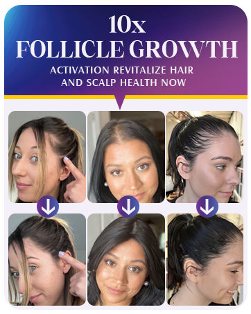 minoxidil for women minoxidil minoxidil foam minoxidil 5% minoxidil foam for women