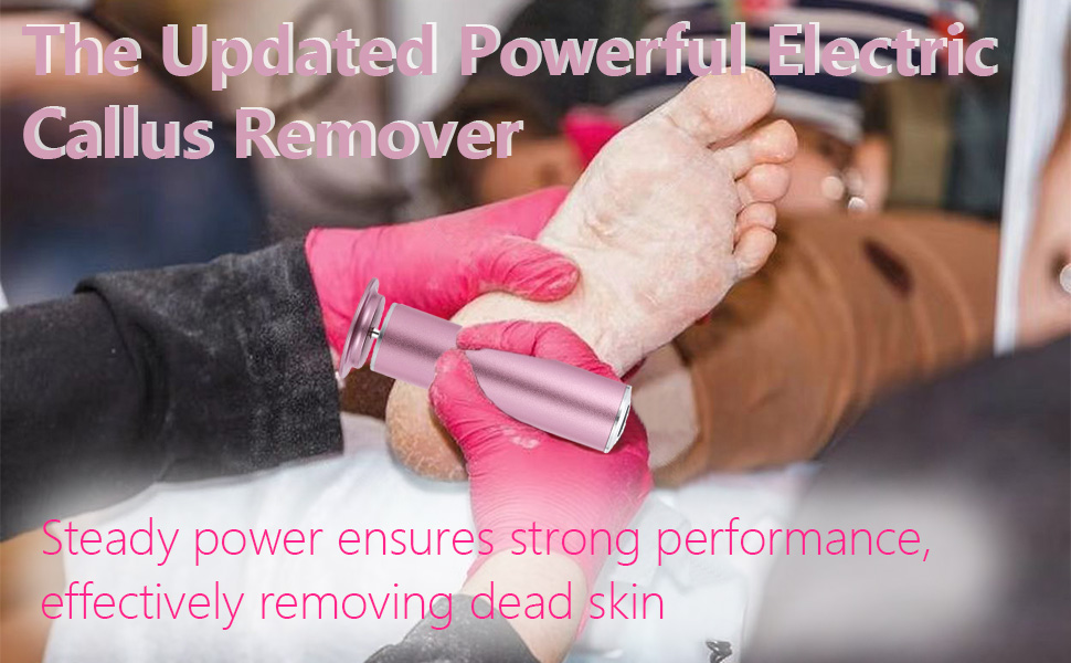 Foot Callus Remover for FootHealth